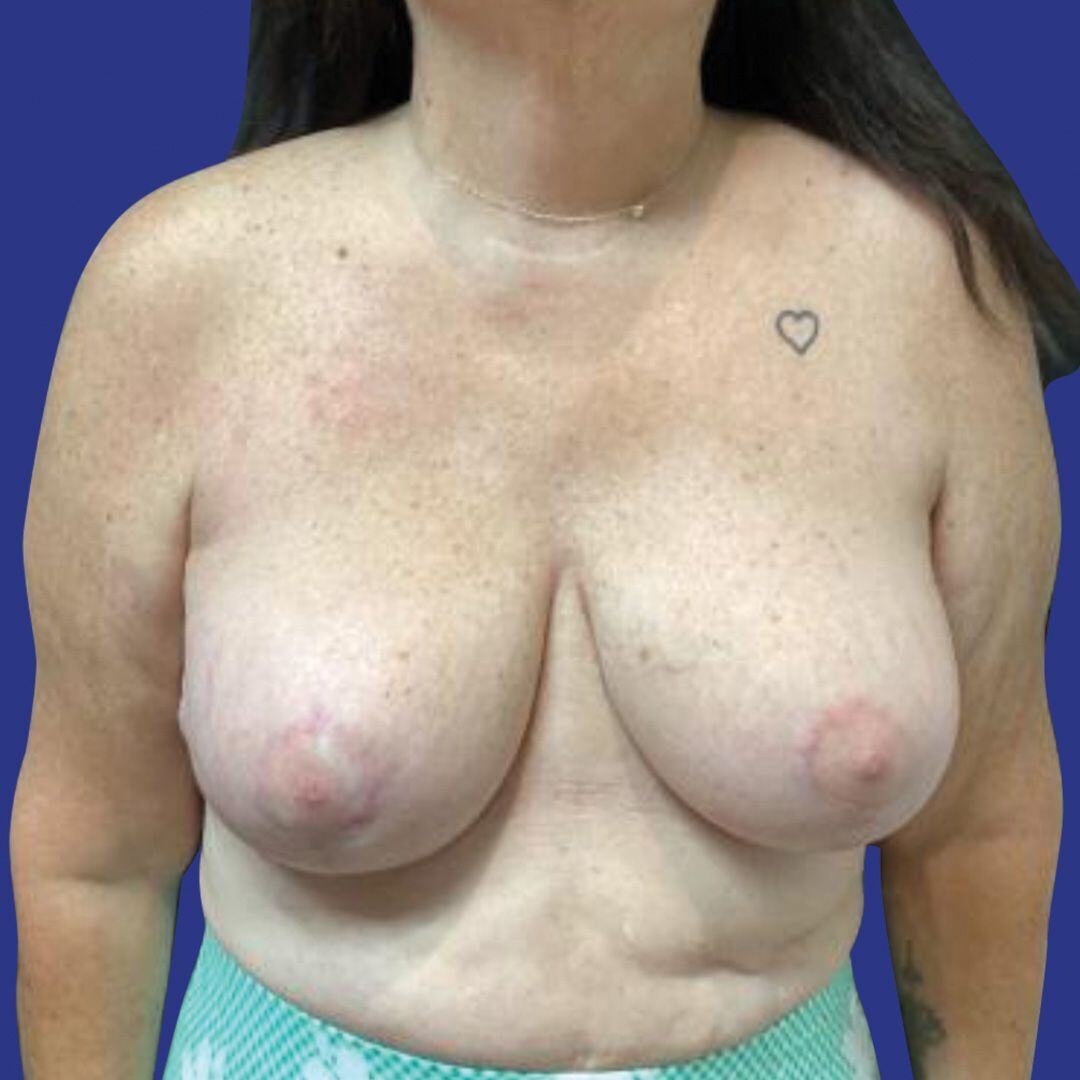 After image
